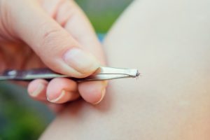Proper Tick Removal: Safely Extracting Ticks to Protect Your Health